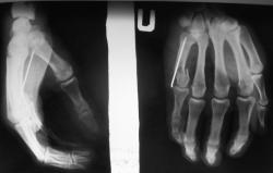 Так выглядит репозиция в умелых руках!!!"2"